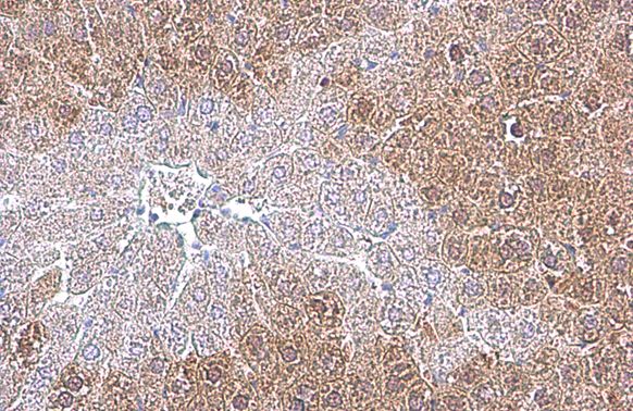 Arginase 1 antibody