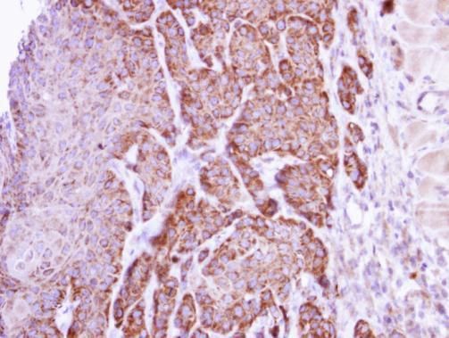 Arginase 1 antibody
