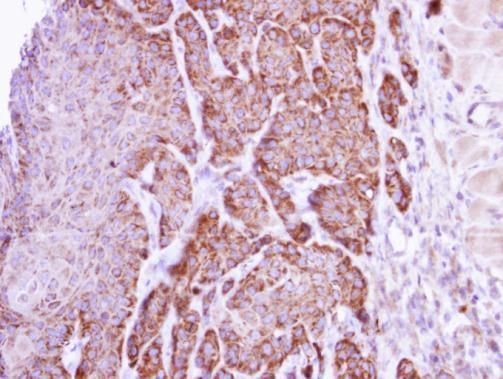 arginase 1 Antibody