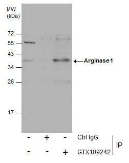 arginase 1 Antibody