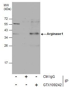Arginase 1 antibody