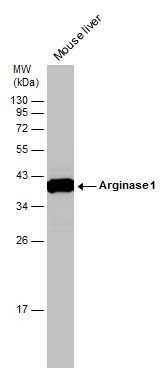 Arginase 1 antibody