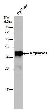 Arginase 1 antibody