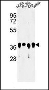 ARGLU1 antibody