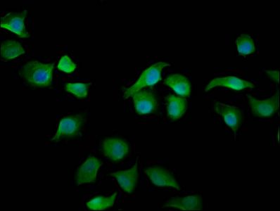 ARHGAP15 antibody