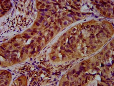 ARHGAP15 Antibody