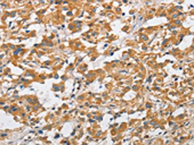 ARHGAP15 antibody