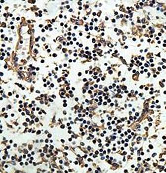 ARHGAP15 Rabbit Polyclonal Antibody