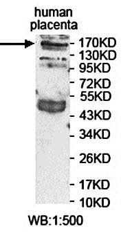 ARHGAP21 antibody