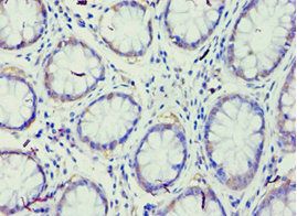 ARHGAP26 Antibody