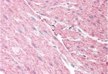 Goat anti-GRAF / ARHGAP26 Antibody