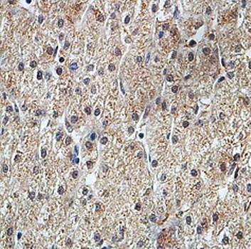 ARHGAP26 Rabbit Polyclonal Antibody