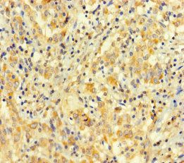 ARHGAP27 Antibody