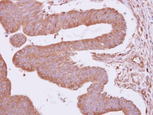 ARHGAP4 antibody [N1N2], N-term