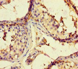 ARHGAP42 Antibody