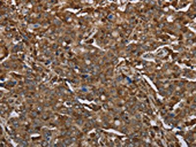ARHGDIA Antibody