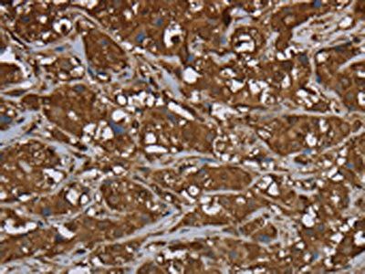 ARHGDIA Antibody