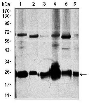 ARHGDIA Antibody