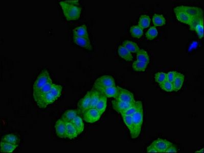 ARHGDIB Antibody