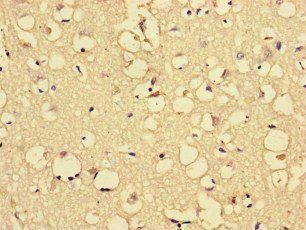 ARHGDIG Antibody