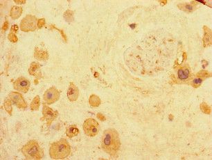 ARHGDIG Antibody