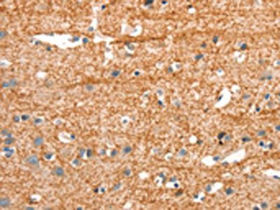 ARHGEF11 Antibody