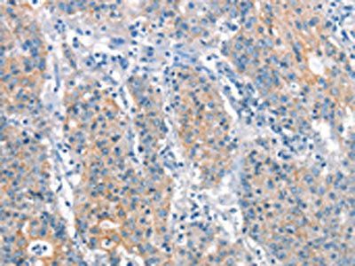 ARHGEF11 Antibody