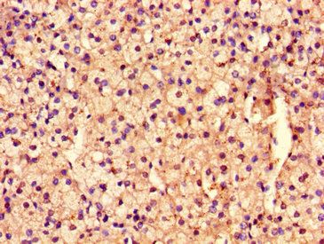 ARHGEF12 Antibody
