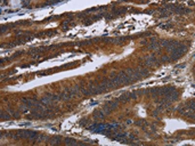 ARHGEF12 Antibody