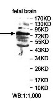 ARHGEF16 Rabbit Polyclonal Antibody
