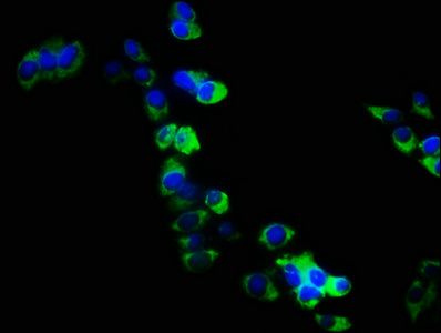 ARHGEF18 Antibody