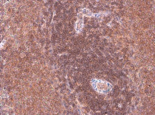 ARHGEF18 antibody