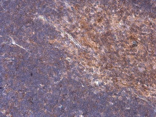 ARHGEF18 antibody
