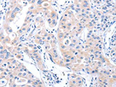 ARHGEF6 Antibody