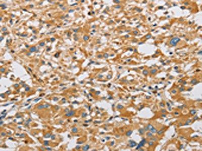 ARHGEF7 Antibody