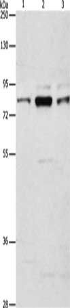 ARHGEF7 Antibody