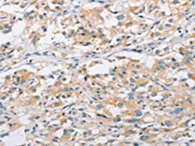 ARHGEF9 Antibody