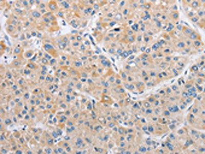 ARHGEF9 Antibody