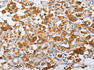 ARHGEF9 Antibody