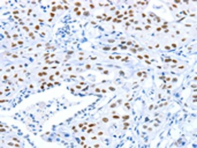 ARID1A Antibody