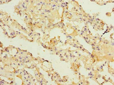 ARL11 Antibody