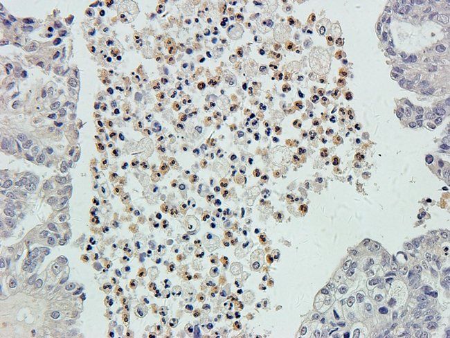 ARL13B antibody