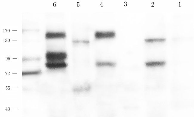 ARL13B antibody