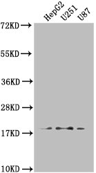 ARL2BP Antibody