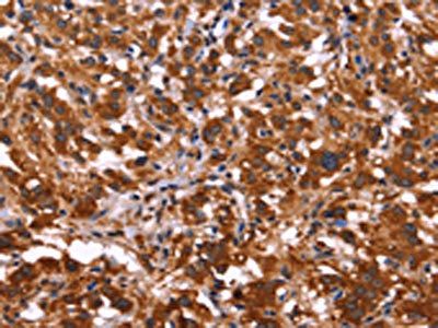ARL4A Antibody