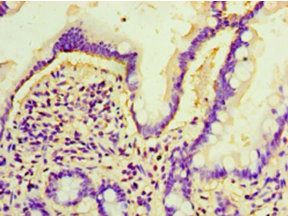 ARL4D Antibody