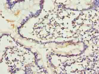 ARL6IP1 Antibody
