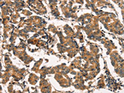 ARL6IP1 Antibody