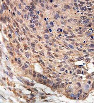 ARMCX5 Rabbit Polyclonal Antibody