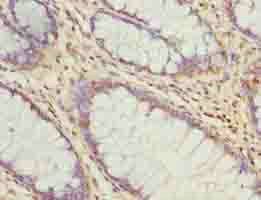 ARMT1 antibody